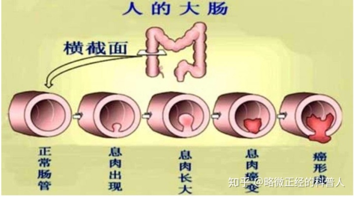 梦见粪便_周公解梦梦见很多粪便_梦见粪便沾身