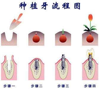 梦见牙齿掉了_小伙喝可乐牙齿掉光_小伙喝可乐大笑