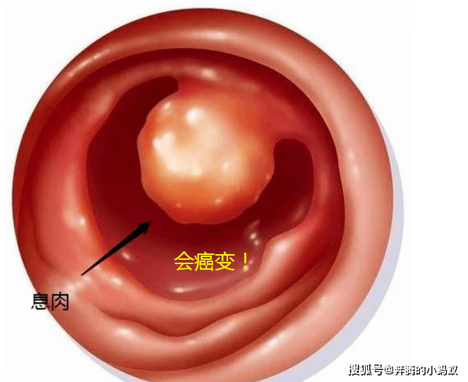 做梦梦见掉牙齿是什么意思_梦见牙齿掉了两颗牙齿_女人梦见掉牙齿是什么意思